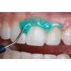 Ultradent - λευκανση - δοντια - OpalDam Green Kit OpalDam - Ρητινώδες υλικό προστασίας 